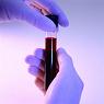 Newbury Data Blood Sample Labelling